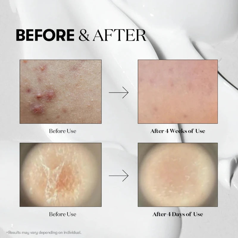 Reedle Shot 100 - Clow Skincare