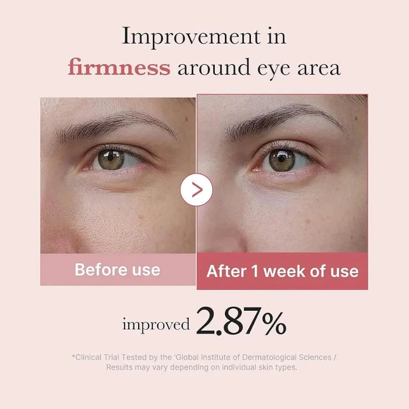 PDRN Pink Peptide Eye Cream - Clow Skincare